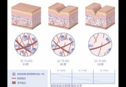 水潤皮膚的秘密武器,乙酰殼糖胺和透明質酸的甜蜜聯盟!